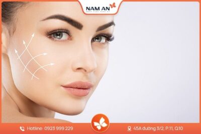 Căng Da Mặt Mini Midface Trẻ Hóa Tầng Giữa Tại Nam An