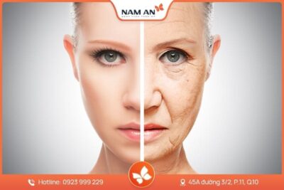 Căng Da Mặt Nội Soi Endoface Toàn Diện Tại BVTM Nam An