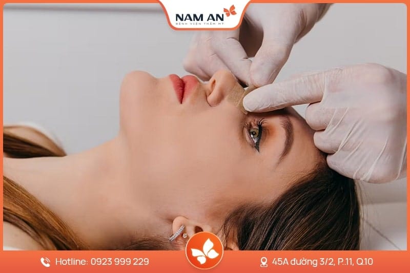 Chỉnh Sửa Mũi Hỏng Co Rút, Biến Dạng Tại BVTM Nam An (12)