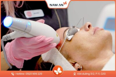 Điều Trị Nám Tận Gốc Bằng Công Nghệ Cao Tại BV Nam An