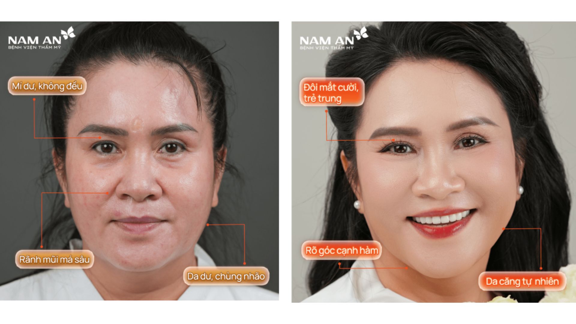 Dịch Vụ Làm Đẹp Cấp Tốc Đón Tết Rạng Ngời (2)