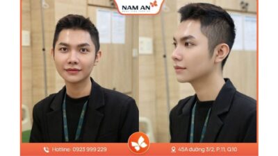 Dịch Vụ Nâng Mũi Nam Giới Chuẩn Lịch Lãm Tại Nam An