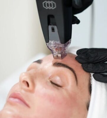Điều Trị Da Công nghệ cao tại Bệnh Viện Thẩm Mỹ HCM