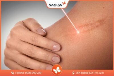 Dịch Vụ Xóa Sẹo Thẩm Mỹ Hiệu Quả Cao Tại BVTM Nam An
