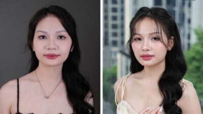 Hành Trình Nâng Mũi Và Vòng 1 Của KOC Thảo Đâyyy