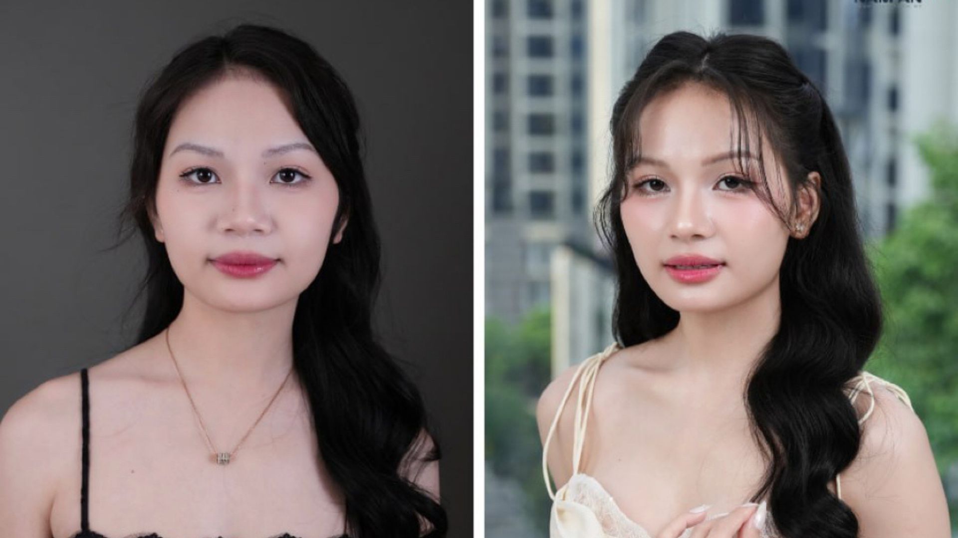 Hành Trình Nâng Mũi Và Vòng 1 Của KOC Thảo Đâyyy (2)