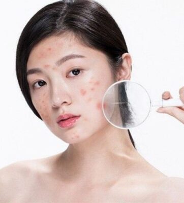 Làm Đẹp Da, điều trị da Tại Bệnh Viện Thẩm Mỹ HCM