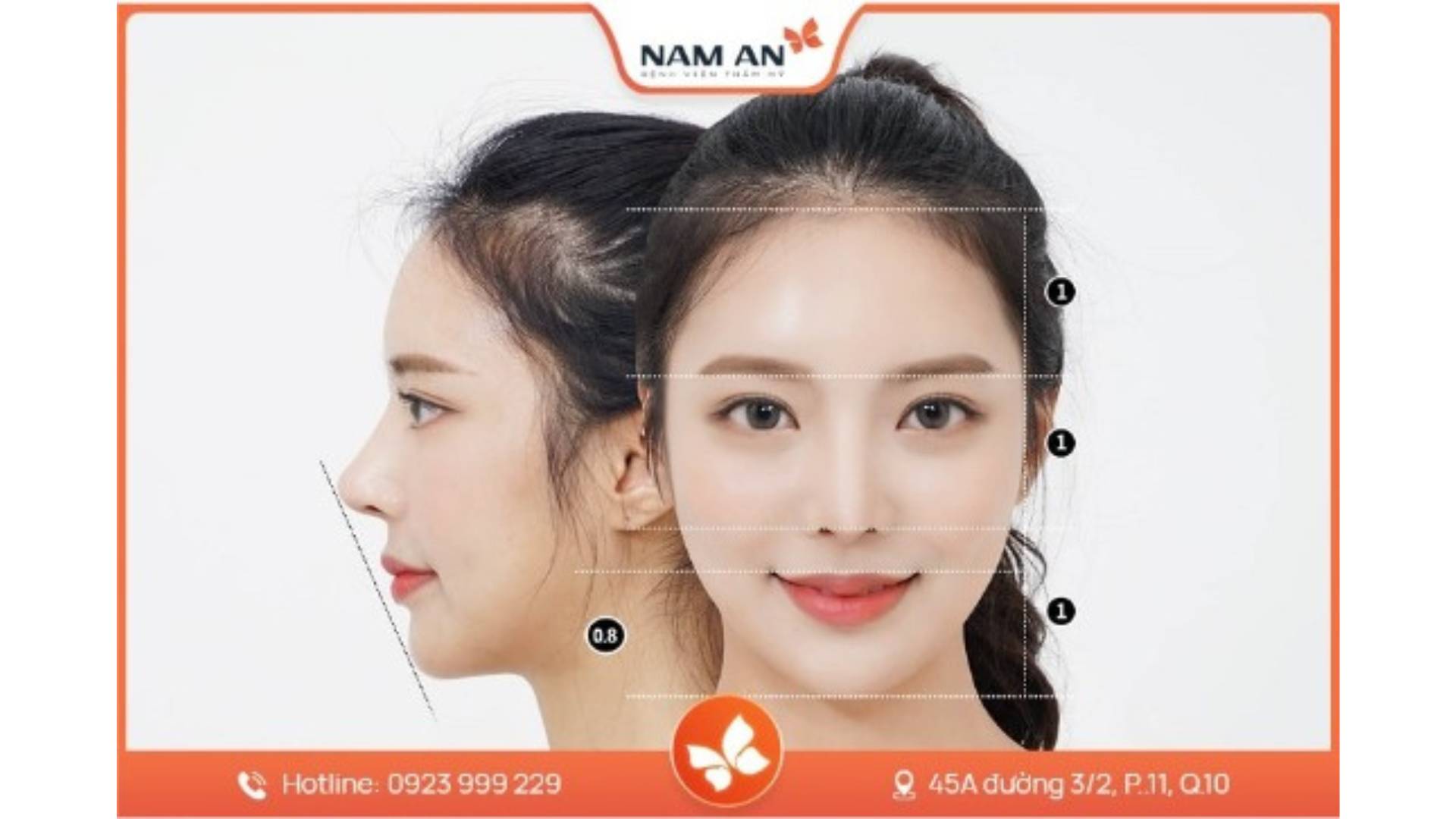 Lưu Ý Quan Trọng Khi Phẫu Thuật Gọt Hàm V-Line (3)