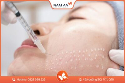 Liệu Trình Truyền Vitamin Trẻ Hóa Da Từ Bên Trong Tại Nam An