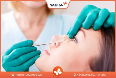 Nâng Mũi Bọc Sụn Tự Nhiên, Ngăn Biến Chứng Tại Nam An