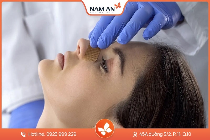 Nâng Mũi Cấu Trúc Toàn Diện (15)