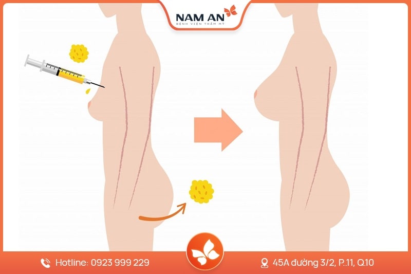 Nâng Ngực Bằng Mỡ Tự Thân Tự Nhiên Chuẩn Y Khoa Tại Nam An (8)