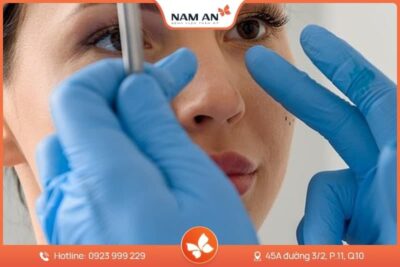 Nâng Mũi Sụn Sườn Tự Thân Cao Cấp Tại BVTM Nam An
