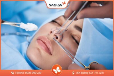 Phẫu Thuật Cuộn Cánh Mũi Thon Gọn Tại BVTM Nam An