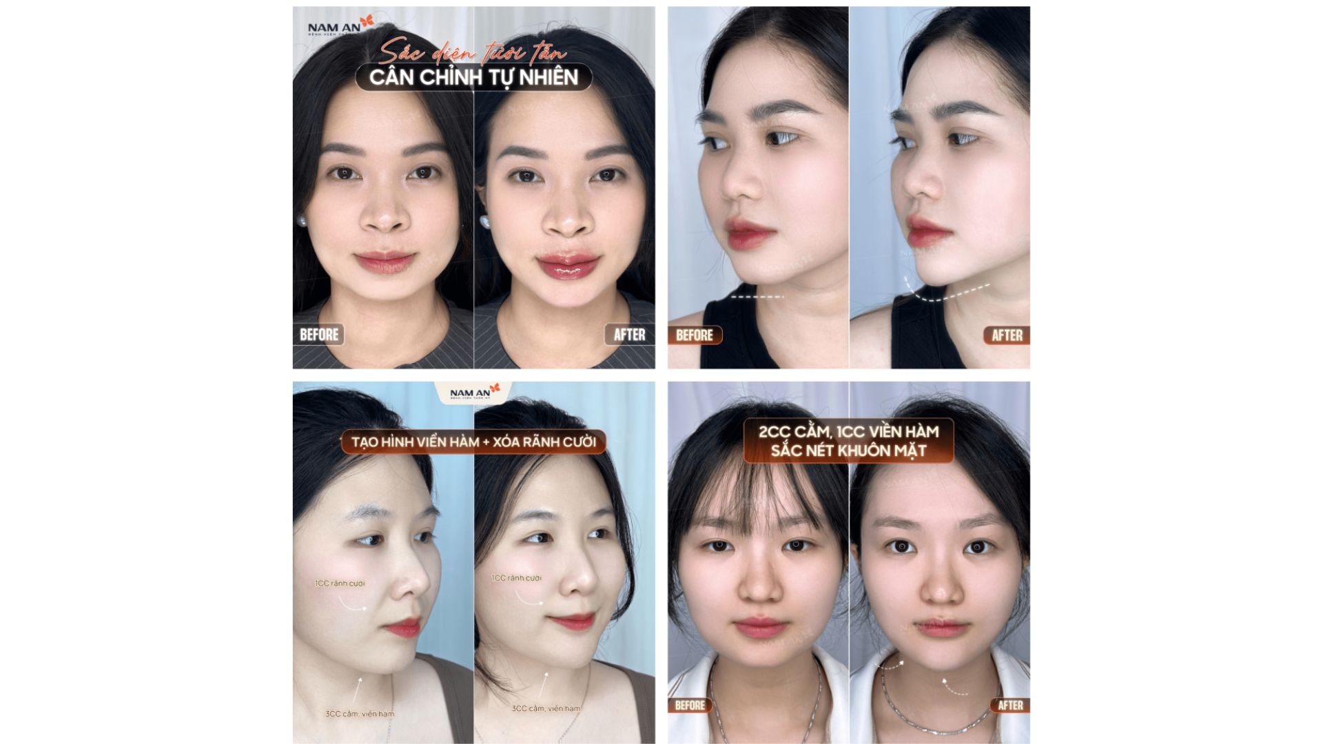 Phương Pháp Trẻ Hóa Không Phẫu Thuật Tại Nam An (3)