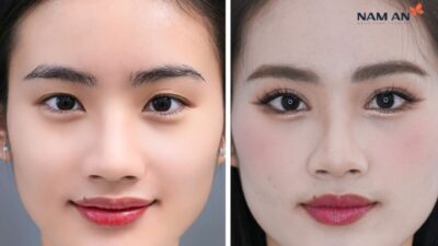 Top 5 Dịch Vụ Thẩm Mỹ Nên Làm Trước Tết Tại Nam An