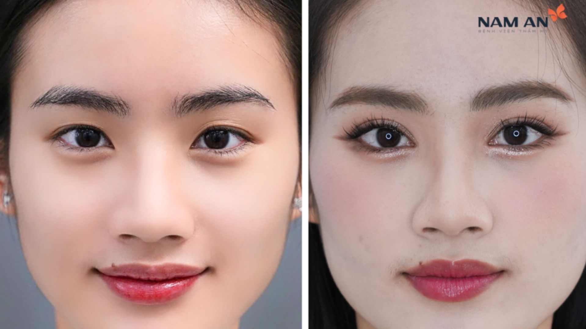 Top 5 Dịch Vụ Thẩm Mỹ Nên Làm Trước Tết Tại Nam An (2)