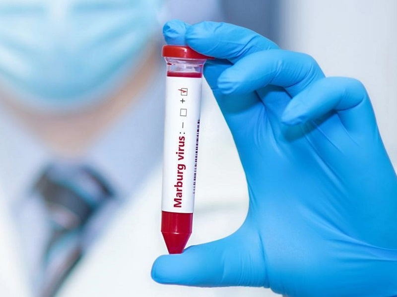 Virus Marburg Là Gì Triệu Chứng Và Cách Phòng Ngừa