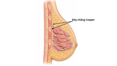 Cấu tạo và vị trí của dây chằng Cooper trong bầu ngực